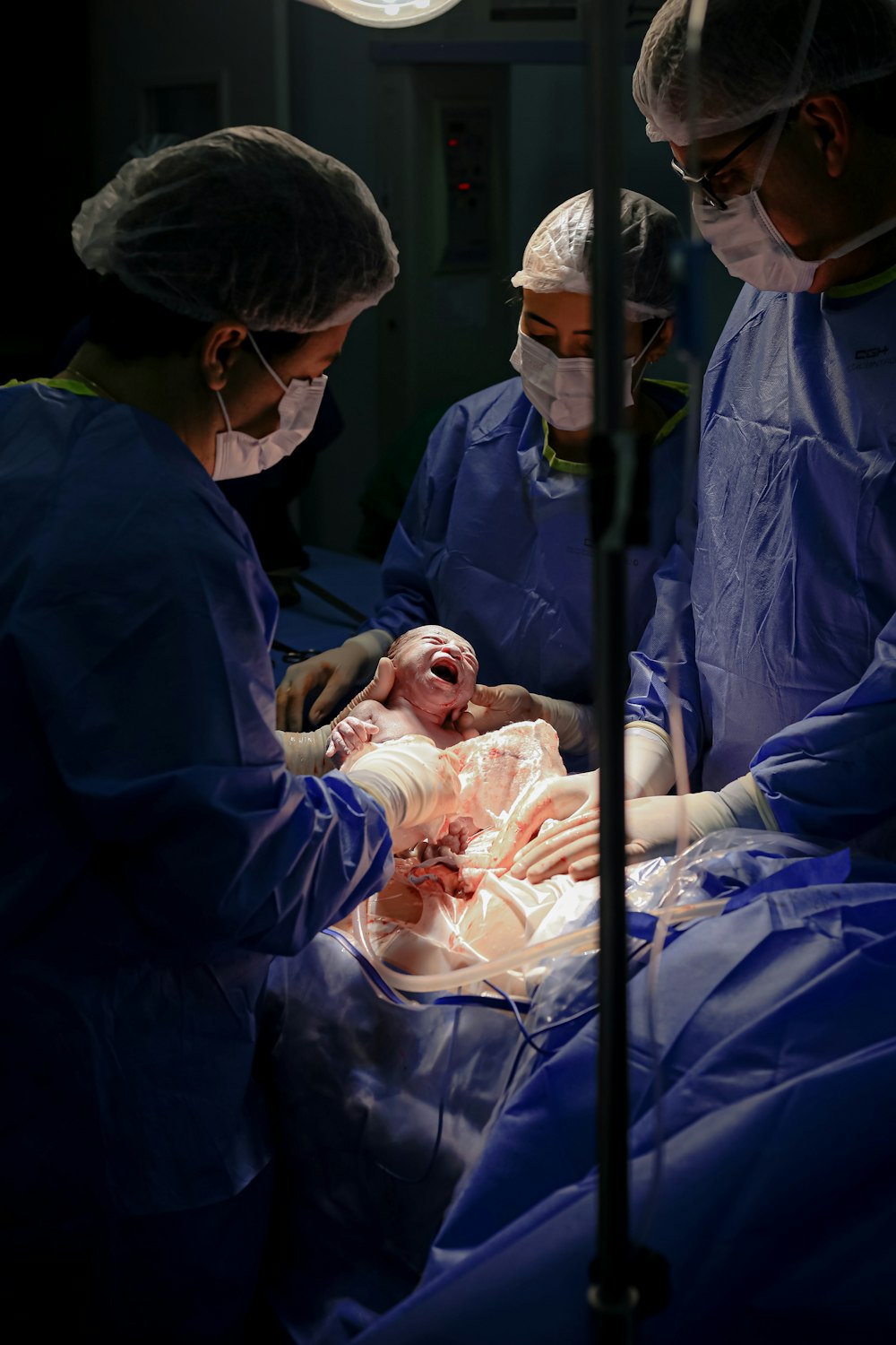 a group of doctors performing surgery on a baby