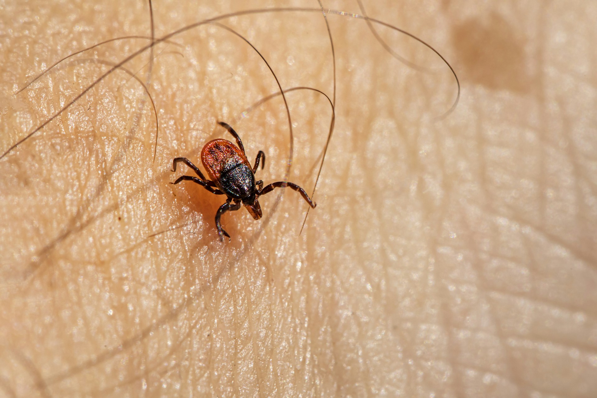 a close up of a bug on a human's skin