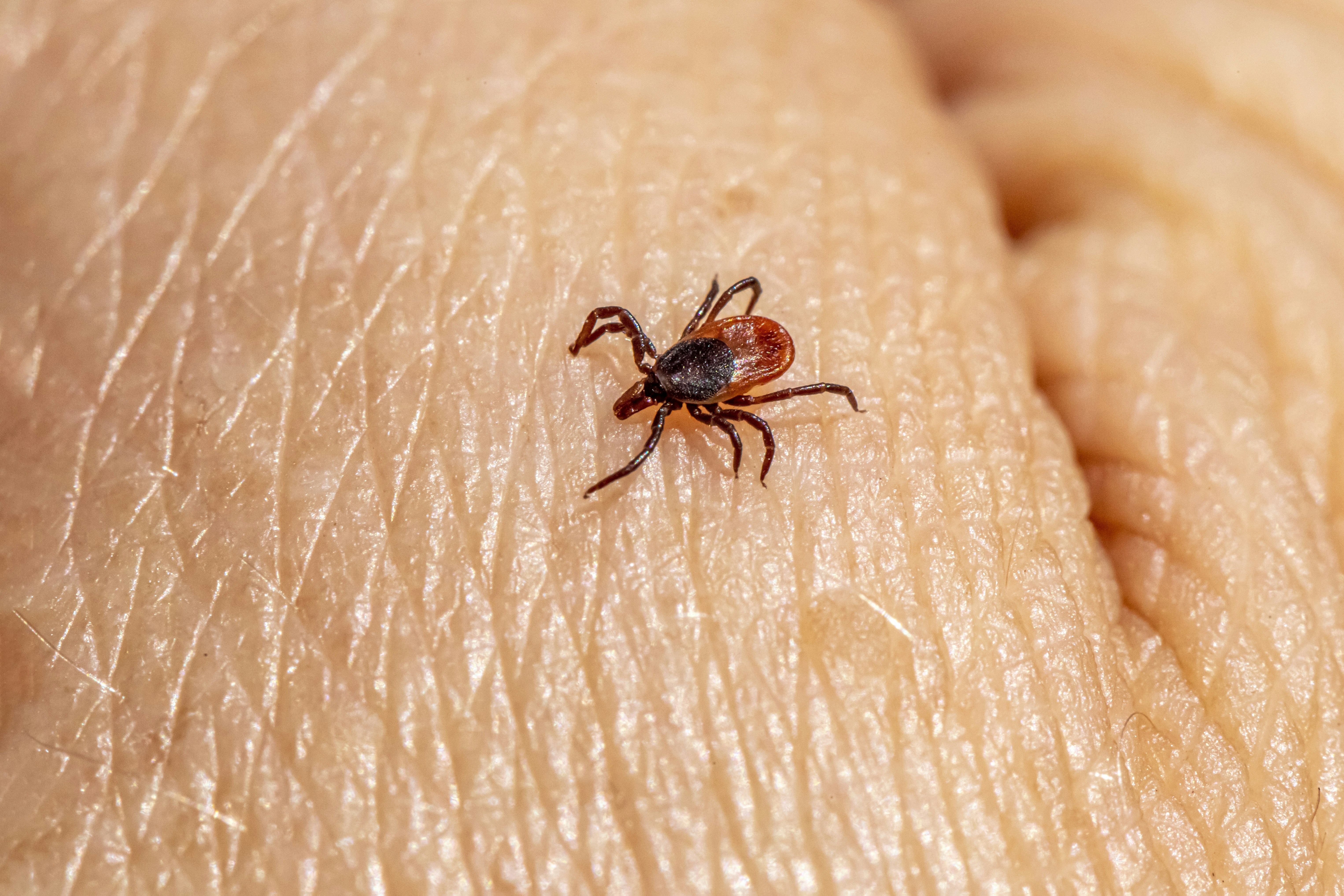 Lyme Disease & Chinese Medicine