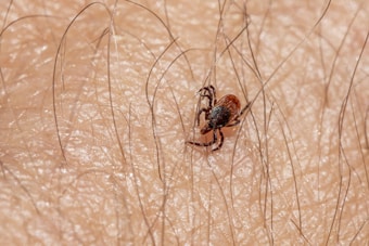 A small tick is crawling on human skin, surrounded by fine, short hair. The tick has a dark brown body with lighter brown accents.