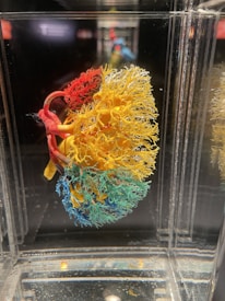 An intricate and colorful anatomical model of a human organ is encased in a glass box. The model showcases a complex network of blood vessels or neural structures, vividly rendered in red, yellow, and blue. Each color section appears to represent different parts of the structure, intertwined and detailed against a dark background, emphasizing the vibrant colors.