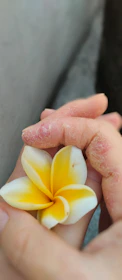 Close-up of hands gently holding tropical flower petals, symbolizing care and transformation.