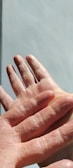 Hands with visibly improved texture and hydration post-treatment.