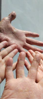 Close-up of diverse hands applying moisturizer, showing texture and natural skin tones.