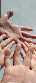 Close-up of diverse hands applying moisturizer, showing texture and natural skin tones.
