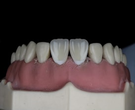 A close-up view of a dental model featuring a full set of artificial teeth with realistic white coloration. The gums exhibit a pink hue, and the teeth are aligned on a display mold against a dark backdrop.