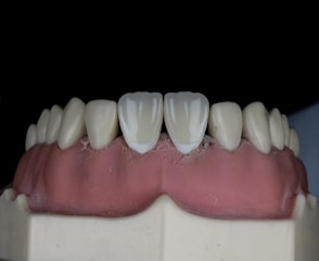 A close-up view of a dental model featuring a full set of artificial teeth with realistic white coloration. The gums exhibit a pink hue, and the teeth are aligned on a display mold against a dark backdrop.