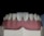 A close-up view of a dental model featuring a full set of artificial teeth with realistic white coloration. The gums exhibit a pink hue, and the teeth are aligned on a display mold against a dark backdrop.