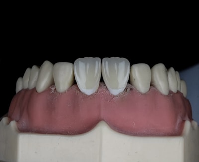 A close-up view of a dental model featuring a full set of artificial teeth with realistic white coloration. The gums exhibit a pink hue, and the teeth are aligned on a display mold against a dark backdrop.