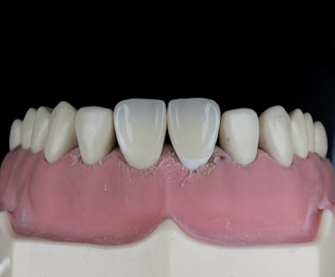 A close-up view of a dental model showcasing upper teeth with a focus on the front two teeth, which appear to be made of a glossy, reflective material. The gums are also visible, depicted in a pink color, and the overall context suggests a dental setting or demonstration.