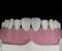 A close-up view of a dental model showcasing upper teeth with a focus on the front two teeth, which appear to be made of a glossy, reflective material. The gums are also visible, depicted in a pink color, and the overall context suggests a dental setting or demonstration.