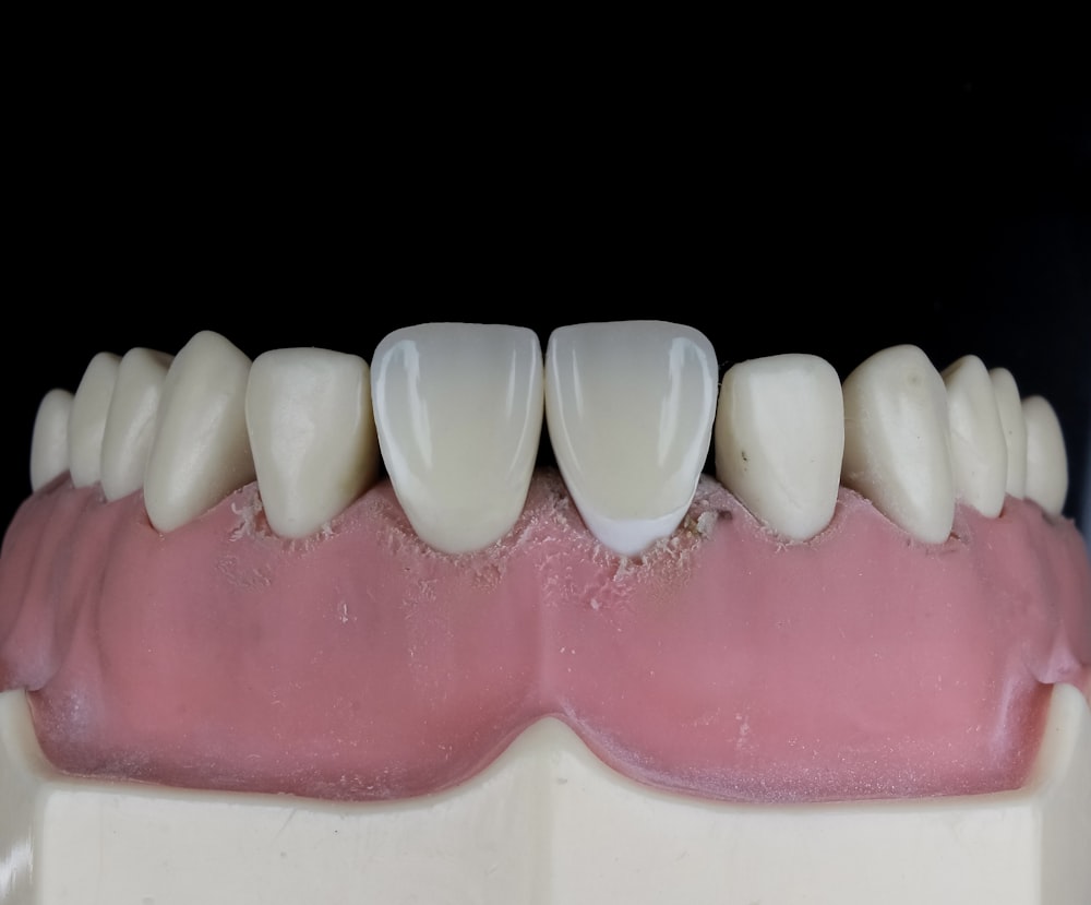 a model of a tooth with white teeth