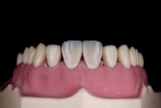 A close-up of a dental model showing human gums and teeth. The model includes two central incisors which are whiter than the surrounding teeth.