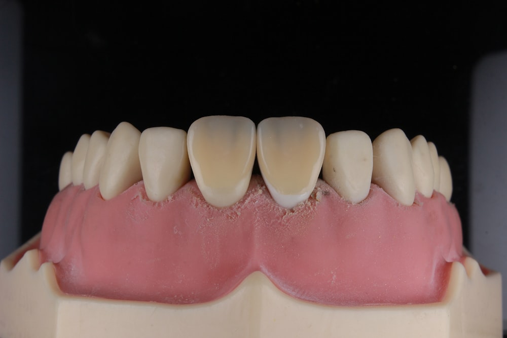 a model of a human's teeth with gums