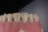 A close-up view of a dental model showing a row of upper teeth, likely made from dental materials for educational or demonstration purposes. The teeth are white and well-aligned, set in a pink gum-like base.
