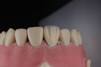 A close-up view of a dental model showing a row of upper teeth, likely made from dental materials for educational or demonstration purposes. The teeth are white and well-aligned, set in a pink gum-like base.