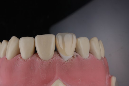 A close-up view of a dental model showing a row of upper teeth, likely made from dental materials for educational or demonstration purposes. The teeth are white and well-aligned, set in a pink gum-like base.