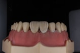 A dental model displaying a set of artificial teeth, with gum-colored material illustrating the mouth structure.