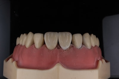 A dental model displaying a set of artificial teeth, with gum-colored material illustrating the mouth structure.