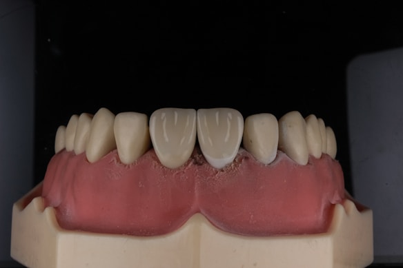 A dental model displaying a set of artificial teeth, with gum-colored material illustrating the mouth structure.