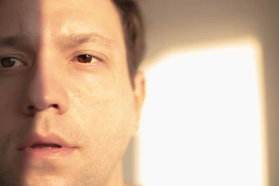 Side-by-side images showing improved skin brightness on a middle-aged man.