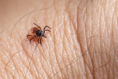 A close-up view of a tick attached to human skin, highlighting the intricate details of its body and legs. The skin appears to be slightly textured with visible hair.