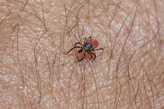 A small tick with a reddish-brown body and black markings is attached to human skin. The skin is covered with fine hair.