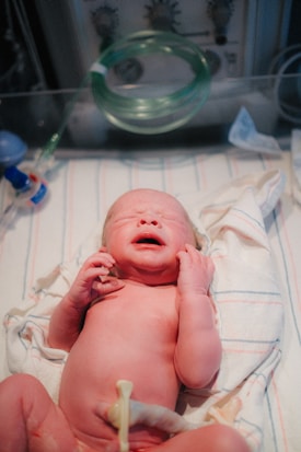 A newborn baby lies on a hospital blanket, appearing to cry with eyes closed and hands clenched. The baby has a fresh umbilical cord clamp on their abdomen. The background includes medical equipment and tubes, suggesting a hospital setting.