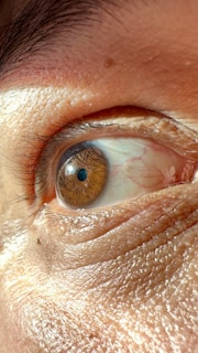 A close-up view of a human eye with prominent skin texture around it. The eye is a brown color with visible eyelashes and a clear reflection of light on the cornea. Small blood vessels can be seen on the sclera.