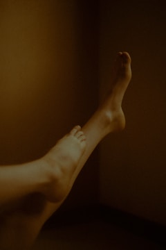 Before and after photos of laser hair reduction on legs