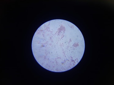 A circular view through a microscope shows various patterns and speckles on a pale background, likely representing cells or microscopic structures. The image is surrounded by a dark border, indicating it is viewed through a lens.