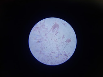 A circular view through a microscope shows various patterns and speckles on a pale background, likely representing cells or microscopic structures. The image is surrounded by a dark border, indicating it is viewed through a lens.