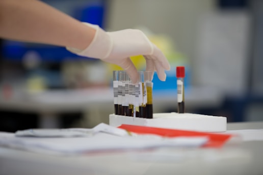 Tubos de coleta, tampa vermelha em laboratóriode Análises Clínicas