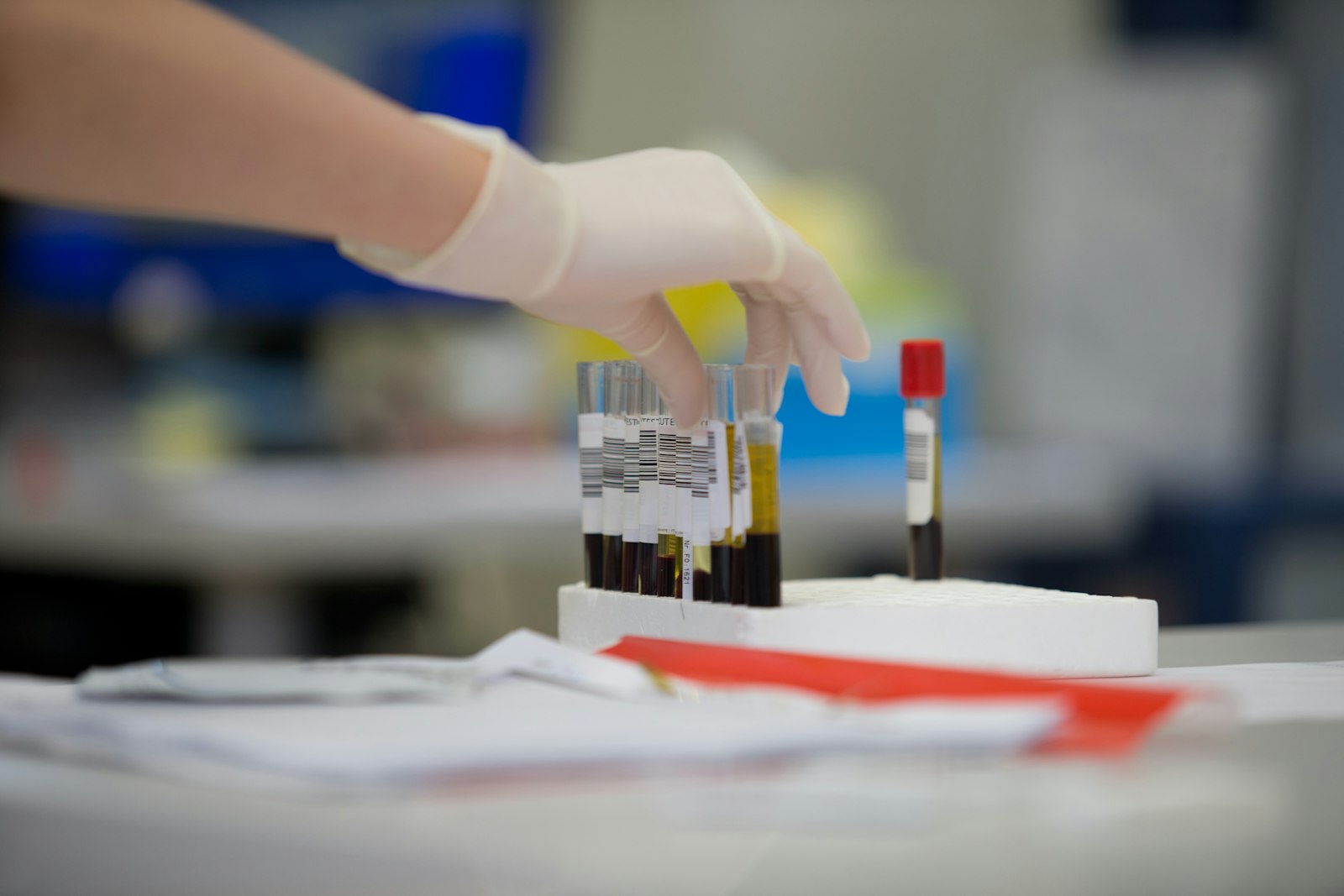 A blood sample vial, the kind used to track the reproductive hormones (LH, FSH, testosterone) that kisspeptin-10's human trials actually measured