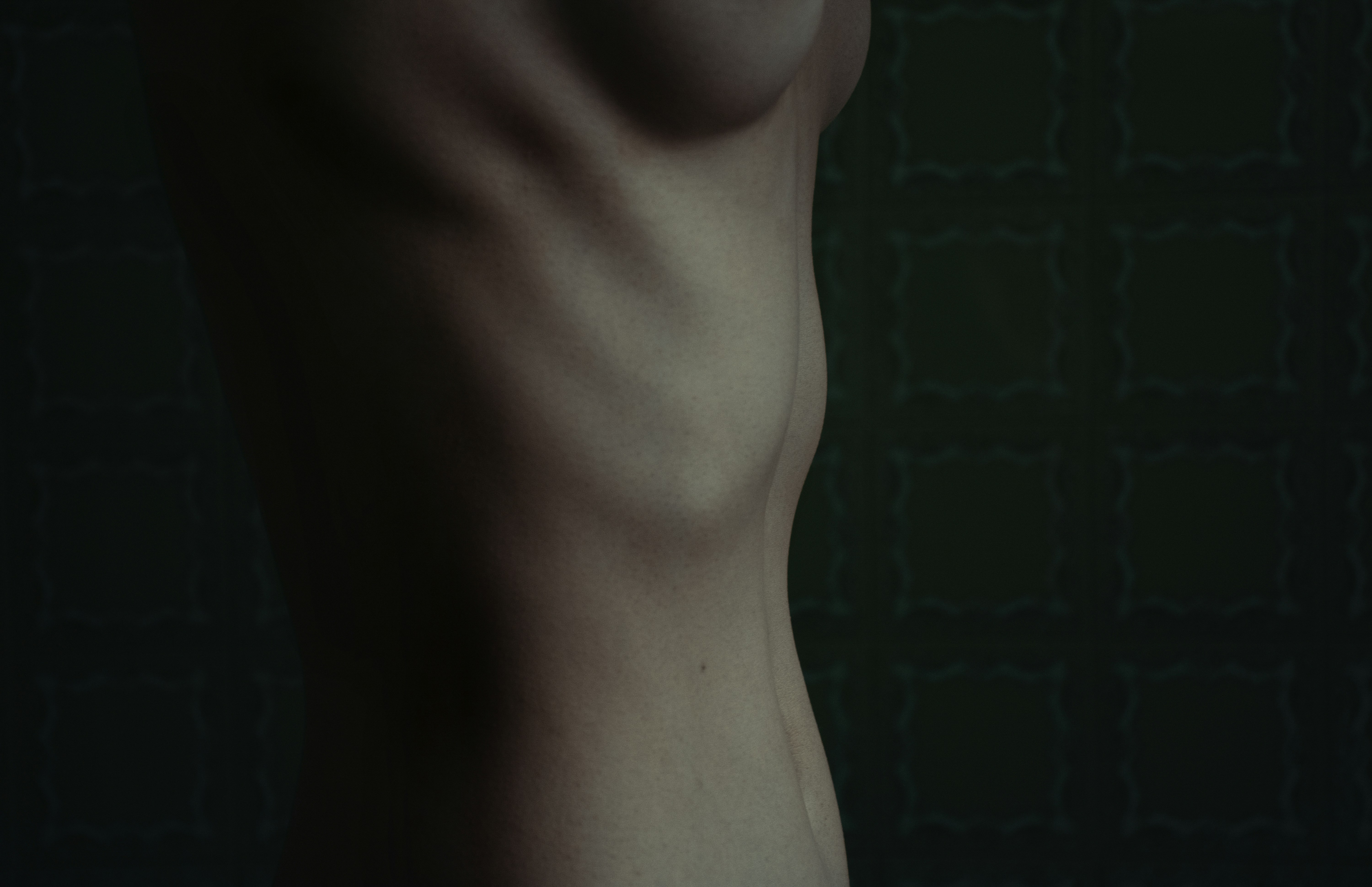 Lipoaspiração HD: Tudo o Que Você Precisa Saber