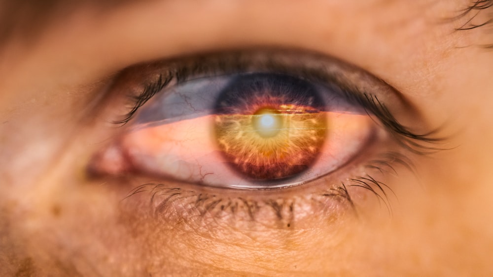 a close up of a person's eye with a yellow iris