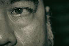 Close-up of a gentle facial treatment focusing on wrinkle reduction.