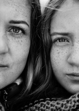 two women with freckled hair are looking at the camera