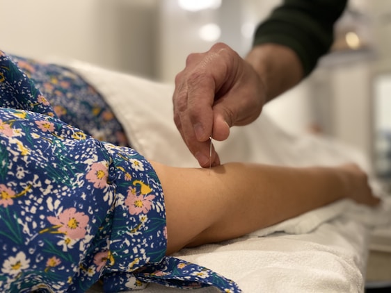A hand carefully inserts an acupuncture needle into the arm of a person who is lying down, wearing a patterned floral dress.