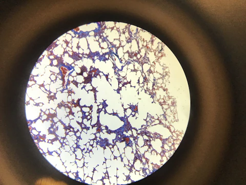 Close-up of a digital microscope lens focusing on complex network structures illuminated in blue tones.