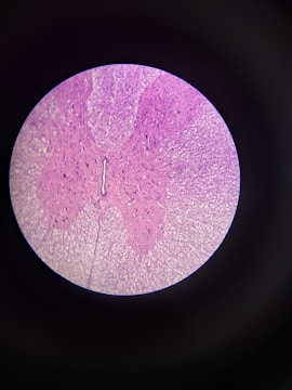 A microscopic view showcasing a detailed cellular structure with varying shades of pink and purple. The circular image emphasizes the textures and patterns typical of biological samples.