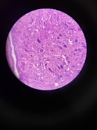 Microscopic view of cells being examined for diagnostic purposes.