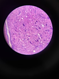 A circular microscopic view showing a tissue sample, characterized by a complex pattern of cell structures in various shades of purple and pink against a dark background.