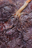 Detailed image showing the intricate network of human blood vessels.