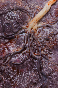 Close-up illustration of blood vessels with highlighted areas showing anti-angiogenesis effects.