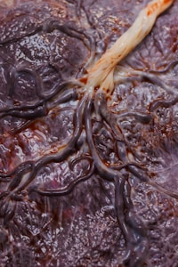 Close-up of a human placenta showing intricate blood vessels and a fleshy texture. The image highlights the network of veins intertwined with the thick, cord-like umbilical structure.