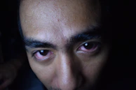 Close-up of skin immediately after RF microneedling, showing slight redness and texture.
