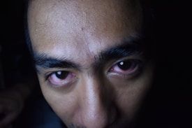A close-up of a person's face focusing on the eyes, which appear red and irritated. The lighting highlights the texture of the skin and the details of the eyebrows and forehead.