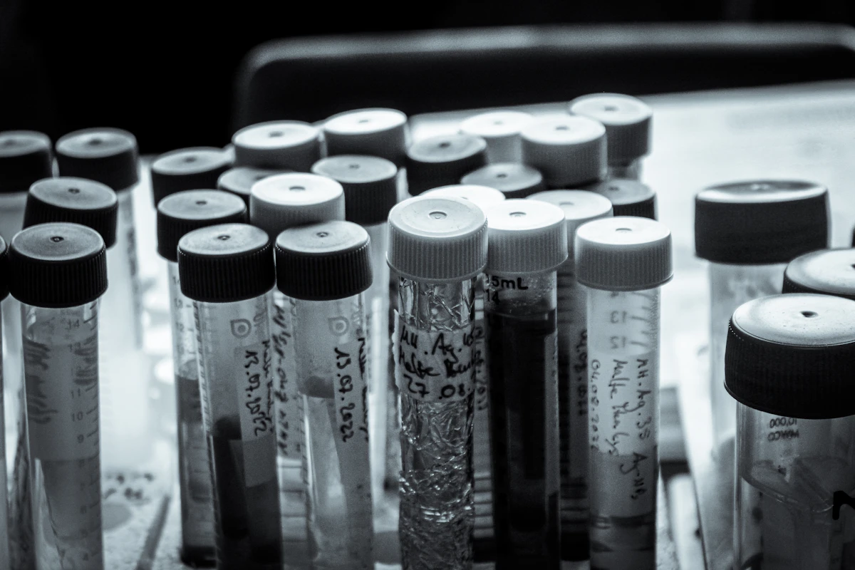 Lab Testing Decoded: What Your Numbers Actually Mean (and What Your Doctor Isn't Telling You)