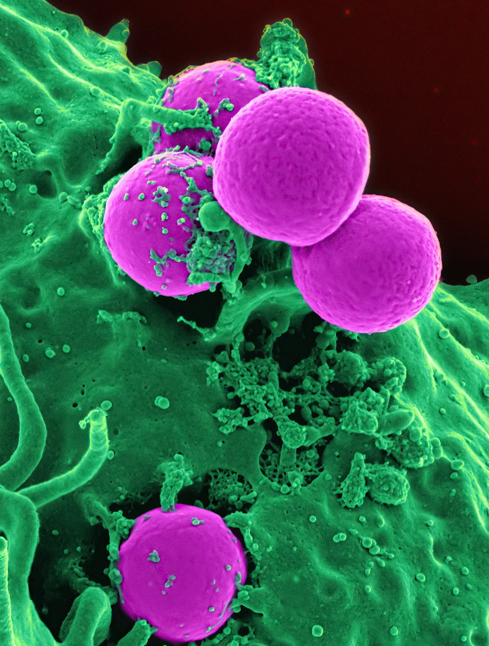 a group of purple and green cells in a blood vessel